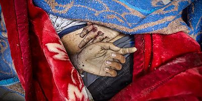 Lancet: Gazze'de can kaybı bildirilenden çok daha yüksek